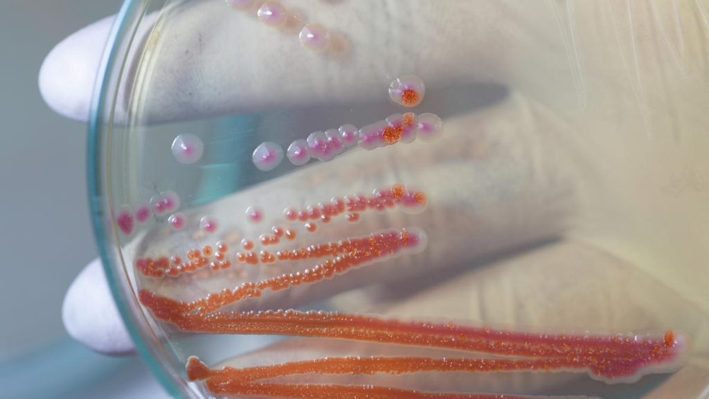 Serratia Marcescens bacteria ce a omorat sase copii