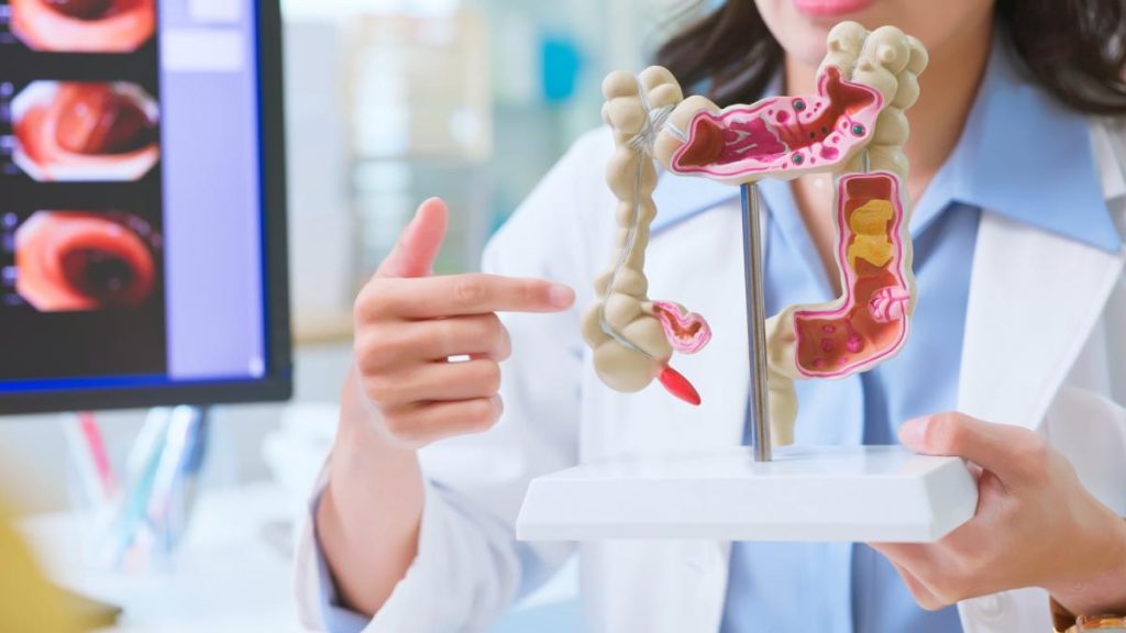 De ce tot mai multi tineri dezvolta cancer de colon In anumite tari aceasta a devenit causa principala de deces
