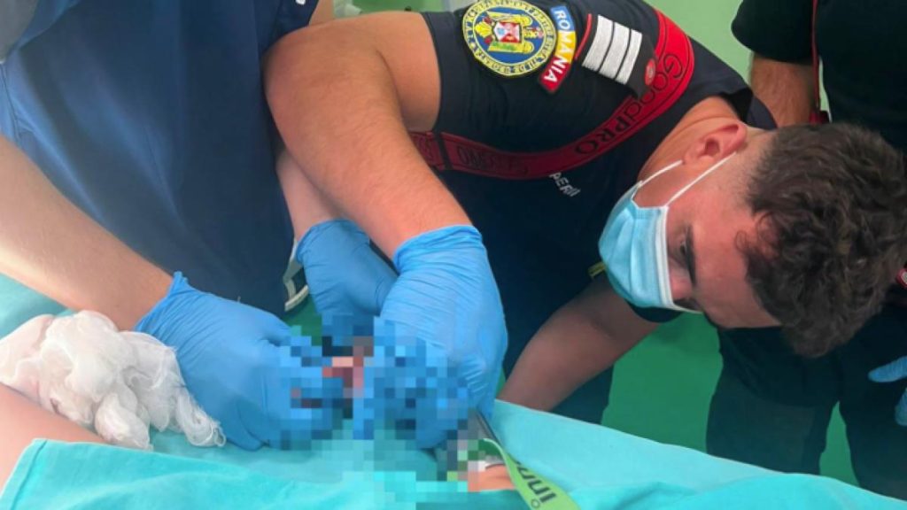 Un copil de 2 ani din Reghin și-a prins mâna în mașina de tocat. Pompierii au intervenit în… Un copil de 2 ani din Reghin si a prins mana in masina de tocat Pompierii au intervenit in