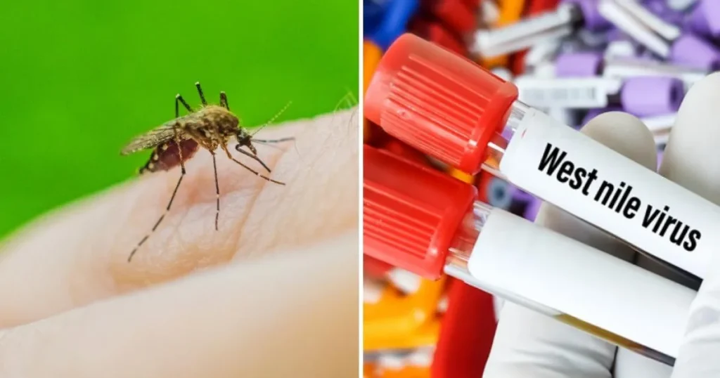 Virusul West Nile: șapte morți în acest sezon în România Virusul West Nile: șapte morți în acest sezon în România